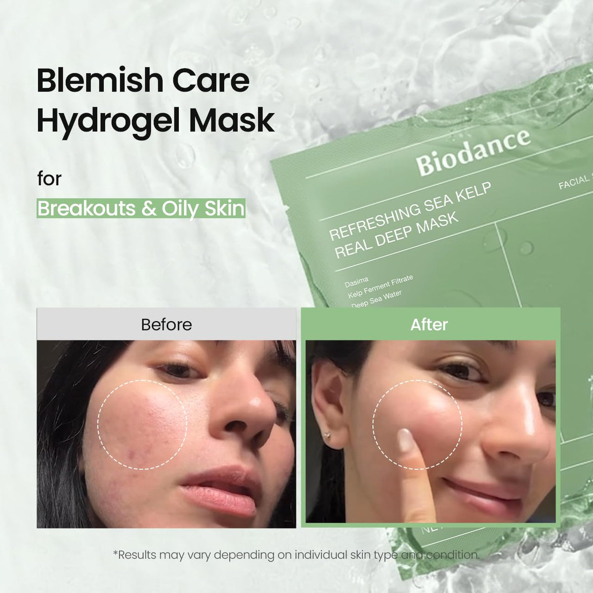 BIODANCE Bio-Collagen Real Deep Mask for Hydrating & Plumping (4ea)