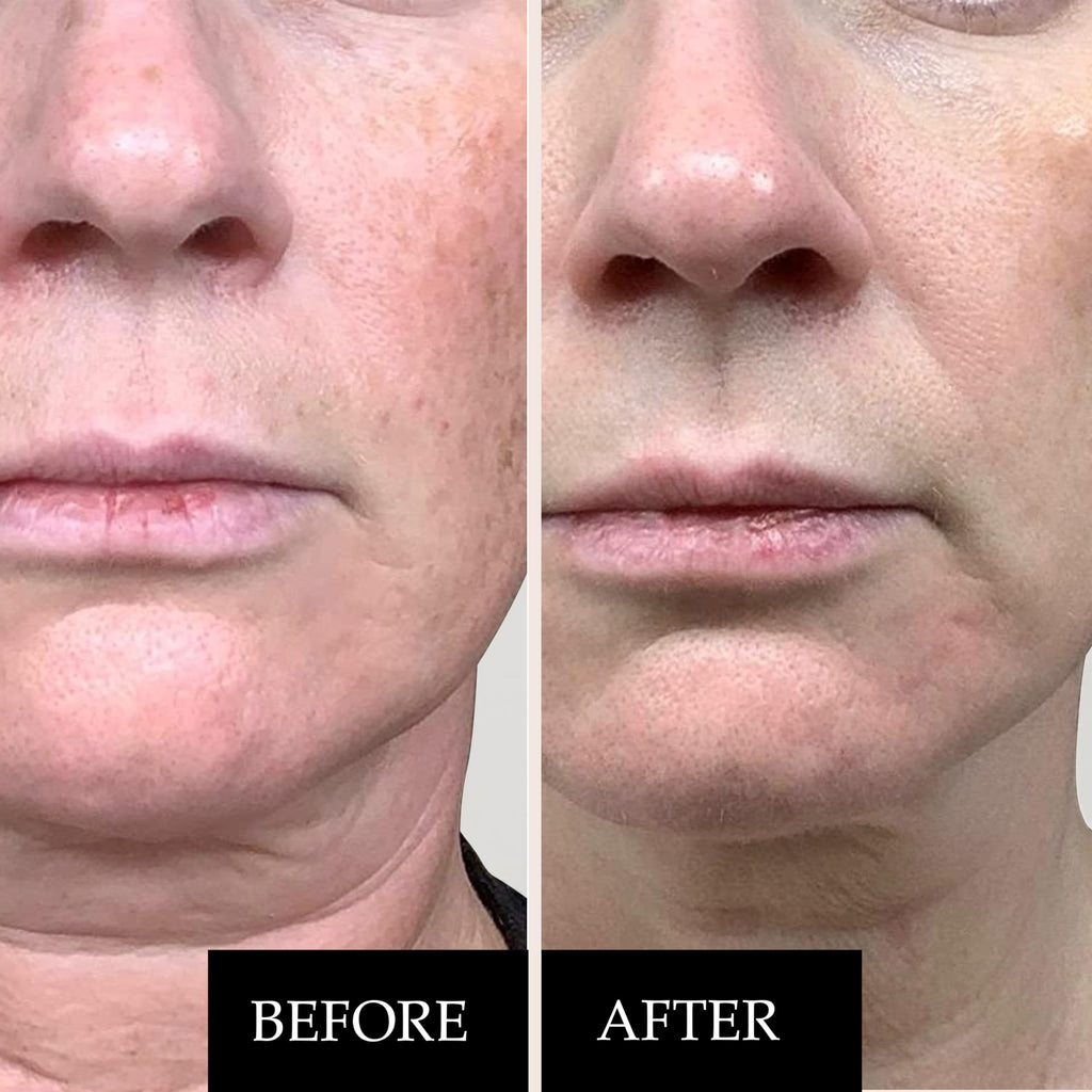 Kleem Organics Pro Collagen Anti Wrinkle Retinol Cream for Face